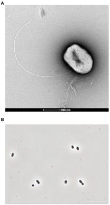 Physiological and comparative proteomic characterization of Desulfolithobacter dissulfuricans gen. nov., sp. nov., a novel mesophilic, sulfur-disproportionating chemolithoautotroph from a deep-sea hydrothermal vent